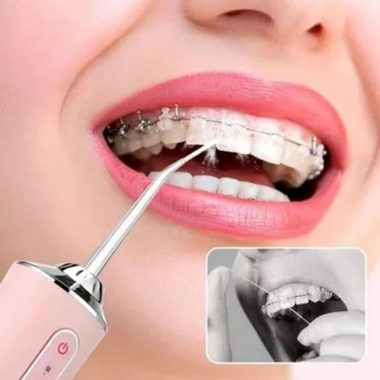 LIMPIADOR IRRIGADOR DENTAL PRO